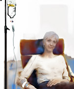 Chemotherapy - main treatment of non-Hodgkins lymphoma